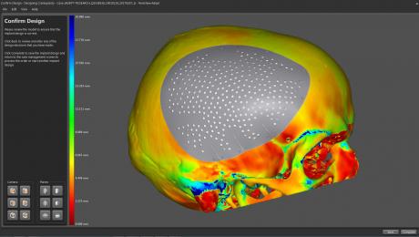 renishaw news Image