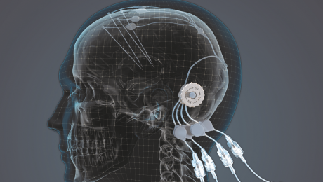 renishaw news Image